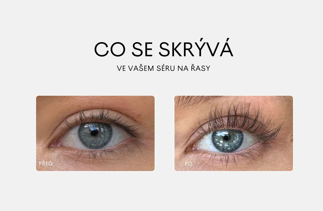 Už žádné prostaglandiny!