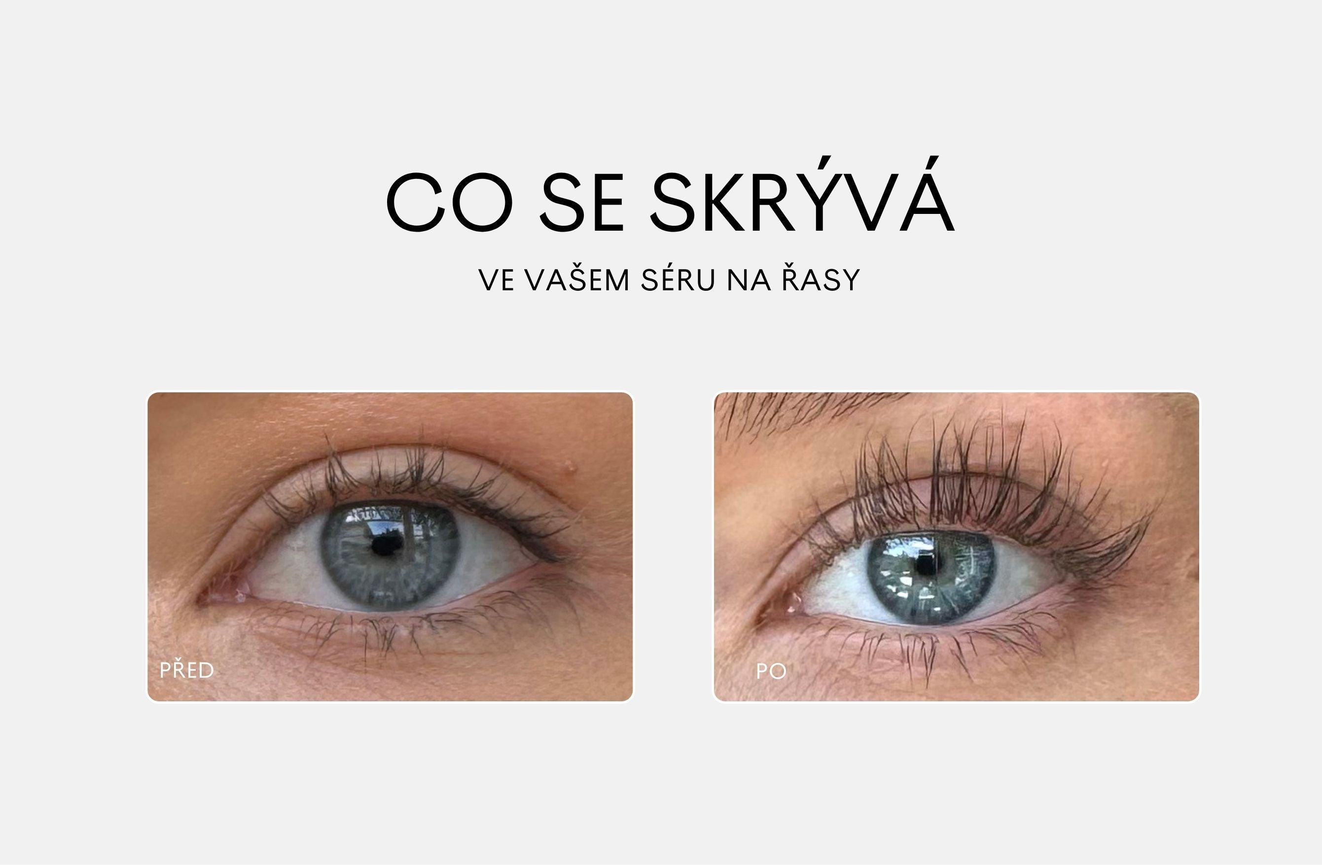 Už žádné prostaglandiny!